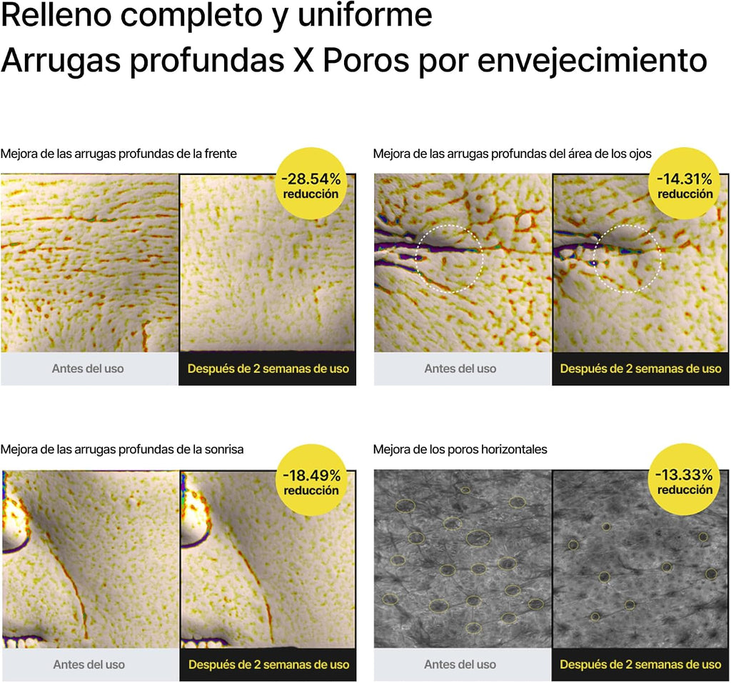 Celimax The Vita-A Retinal Shot:  luce un rostro firme y sin arrugas