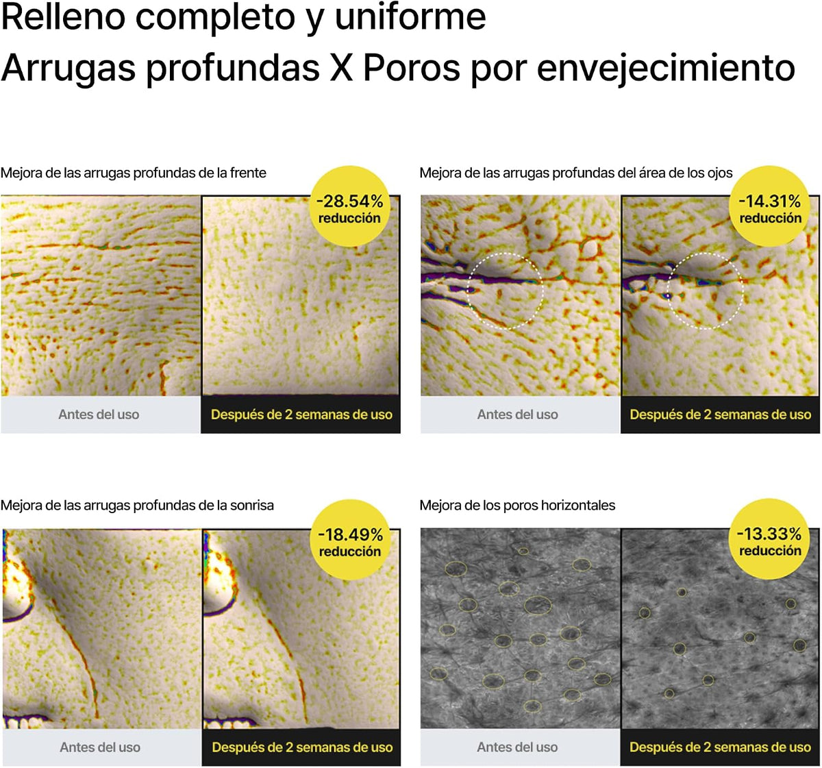 Celimax The Vita-A Retinal Shot:  luce un rostro firme y sin arrugas
