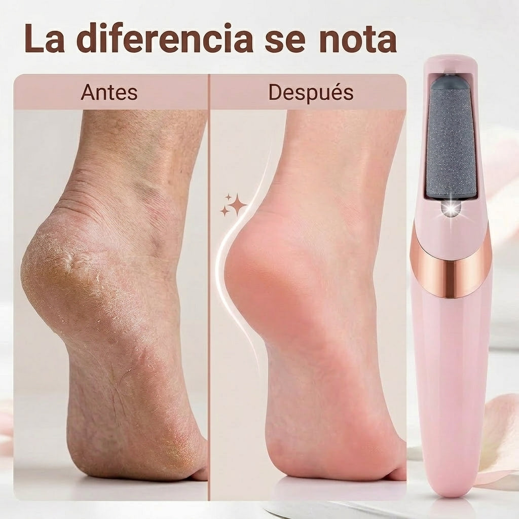 Removedor Eléctrico de Callos - Pies suaves sin pedicura